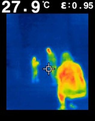 Flir Thermal Imaging Camera